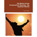 My Below Knee Amputation Journey - By Aashish Mehta