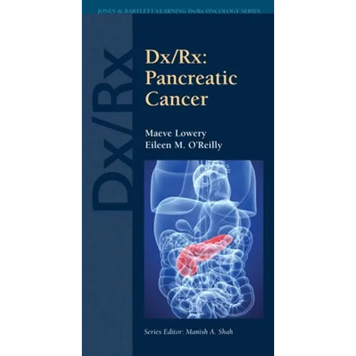 DX/Rx: Pancreatic Cancer: Pancreatic Cancer - Paperback