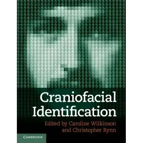 Craniofacial Identification - Hardcover
