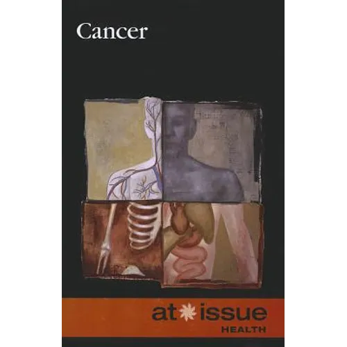 Cancer - Paperback