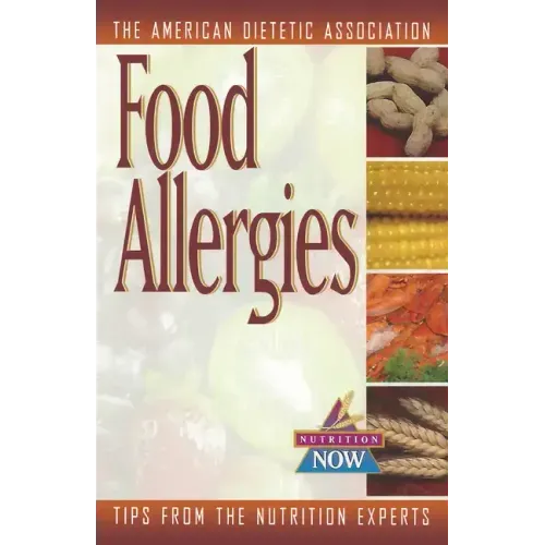 Food Allergies: The Nutrition Now Series - Paperback