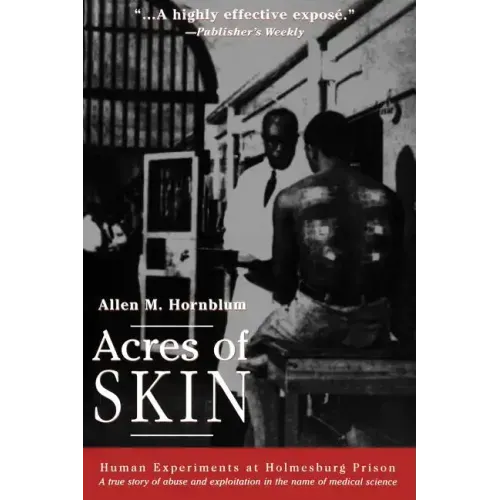 Acres of Skin: Human Experiments at Holmesburg Prison - Paperback