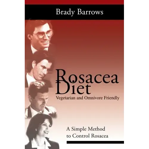 Rosacea Diet: A Simple Method to Control Rosacea - Paperback